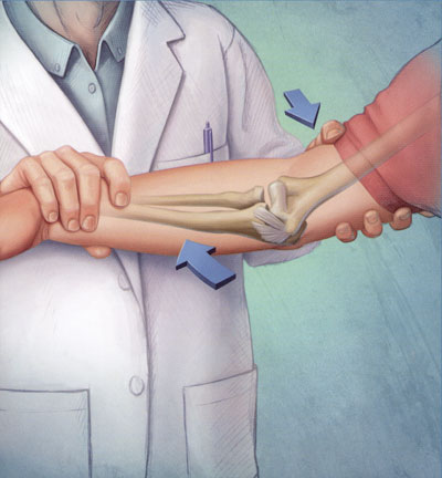 diagram of Ulnar Nerve and moving elbow