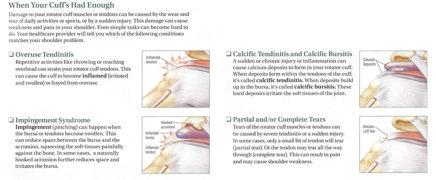 Dr. John Skedros Shoulder Procedures