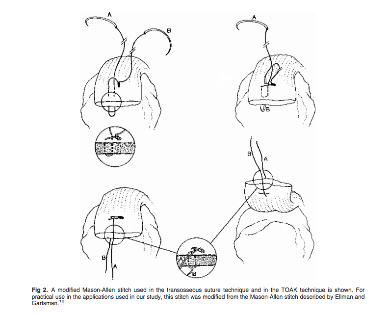 Fig 2A